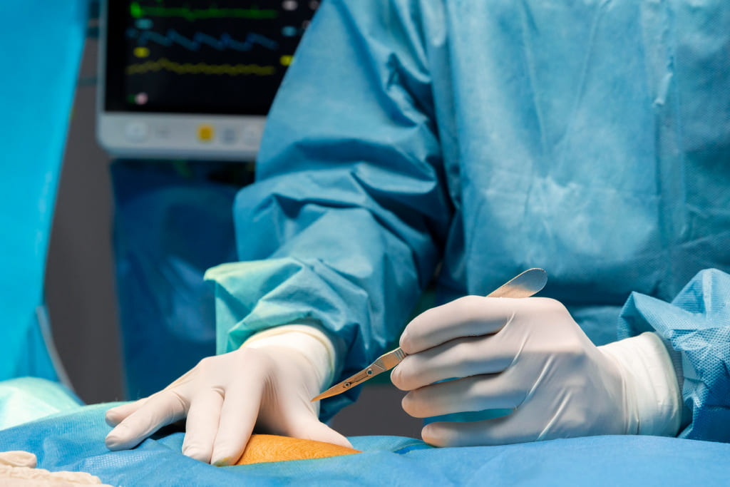 Бариатрическая хирургия бариатрическая хирургия