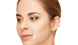 Лифтинг средней зоны лица