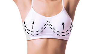 Подтяжка груди