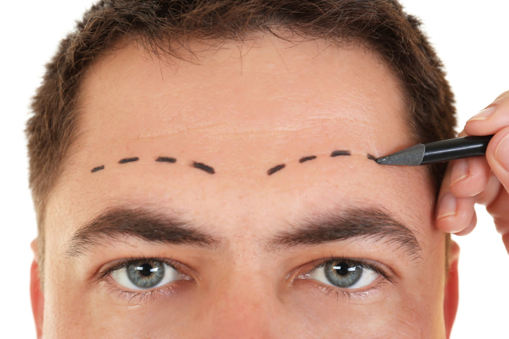 Лифтинг лба Лифтинг лба