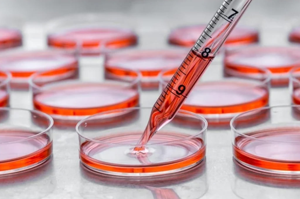 Пересадка стволовых клеток