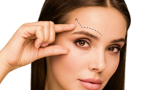 подтяжка бровей