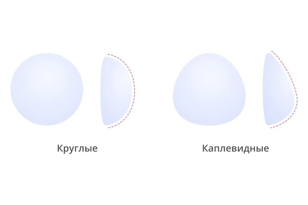 Импланты для увеличения груди Импланты для увеличения груди
