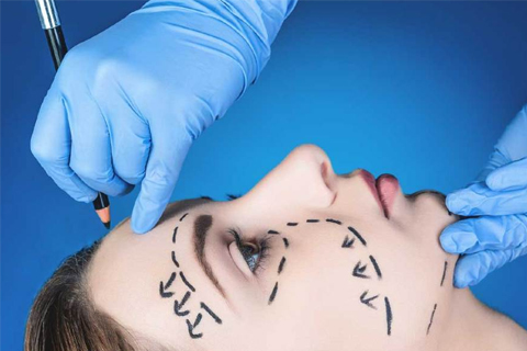 Подготовка к фейслифтингу подготовка к операции по подтяжке лица