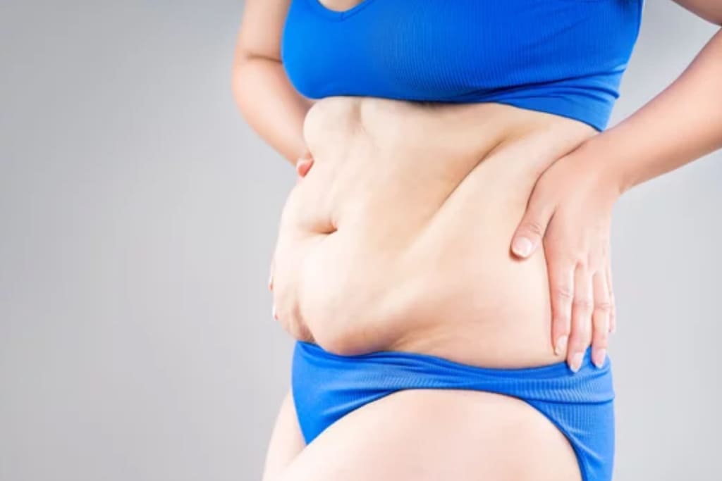 Показания к абдоминопластике показания к абдоминопластике