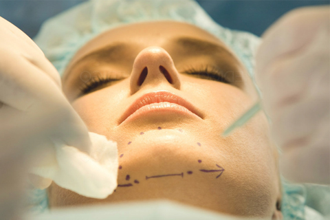 Подготовка к ментопластике Подготовка к ментопластике